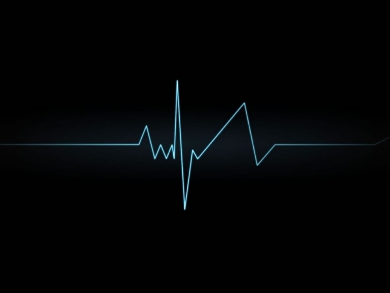 Electrocardiogramas